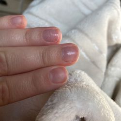 See the texture of my nails from when they peeled off the coating.. causing my nail to be very thin.
