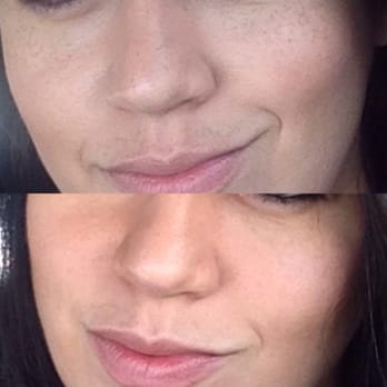 The Beauty Medics - Obagi skin treatment - Medical Spas Near Me - Riverside, California The Beauty Medics - Obagi skin treatment - Medical Spas Near Me - Riverside, California