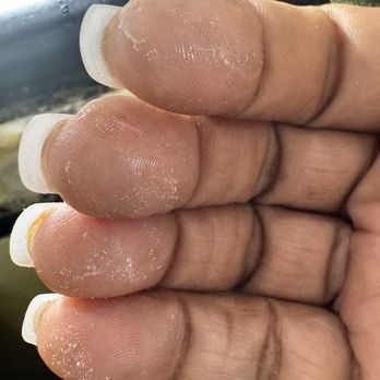 Lee Nails& Spa - Crazy glue from sloppy nail tech older Asian man. - Nail Salons Near Me - Hampton, Virginia Lee Nails& Spa - Crazy glue from sloppy nail tech older Asian man. - Nail Salons Near Me - Hampton, Virginia