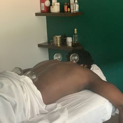 Pulse Community Care - Cupping for back tension