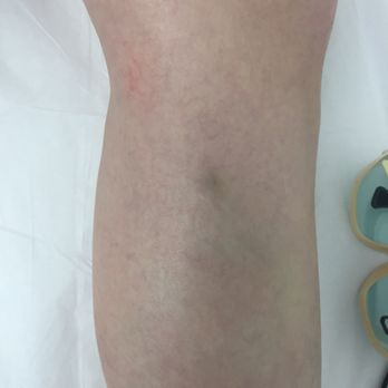 Simin Aesthetic Laser - Laser Hair Removal Near Me - Brooklyn, New York Simin Aesthetic Laser - Laser Hair Removal Near Me - Brooklyn, New York