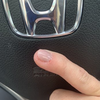 Pink & White Nails - Hair Removal Near Me - Denver, Colorado Pink & White Nails - Hair Removal Near Me - Denver, Colorado