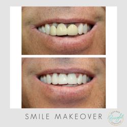 Bright Inspired Dentistry