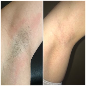 Bizzy Bre’s Wax - Underarm Wax $20 - Hair Removal Near Me - Turlock, California