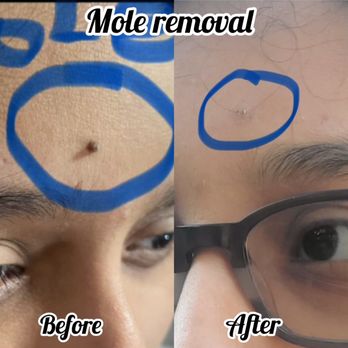 Bellissimo You - "Bellissimo You" (813)766-0119 - Skin Care Near Me - Tampa, Florida Bellissimo You - "Bellissimo You" (813)766-0119 - Skin Care Near Me - Tampa, Florida