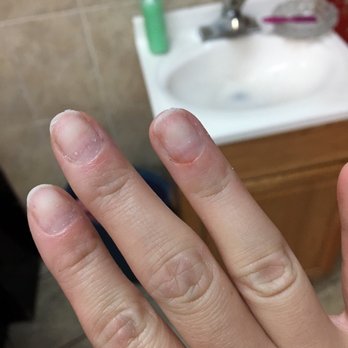 Grace Nails - Bleeding finger. NOT COOL. - Nail Salons Near Me - Elizabeth, New Jersey