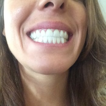 Noble Dental Care - My amazing teeth! - Orthodontists Near Me - Bellflower, California