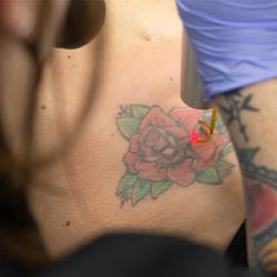 Removery Tattoo Removal & Fading