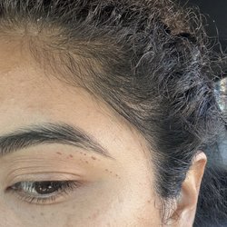 This was one week after getting my eyebrows done. Still have half the scabs after ONE WHOLE WEEK!