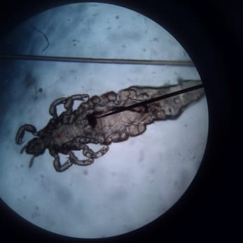 Head Lice Guru - Lice Services Near Me Head Lice Guru - Lice Services Near Me