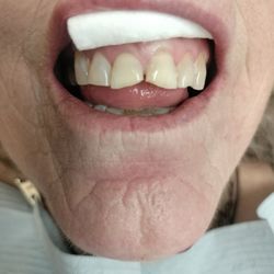 Cal Select Dental Group - Before UGLY