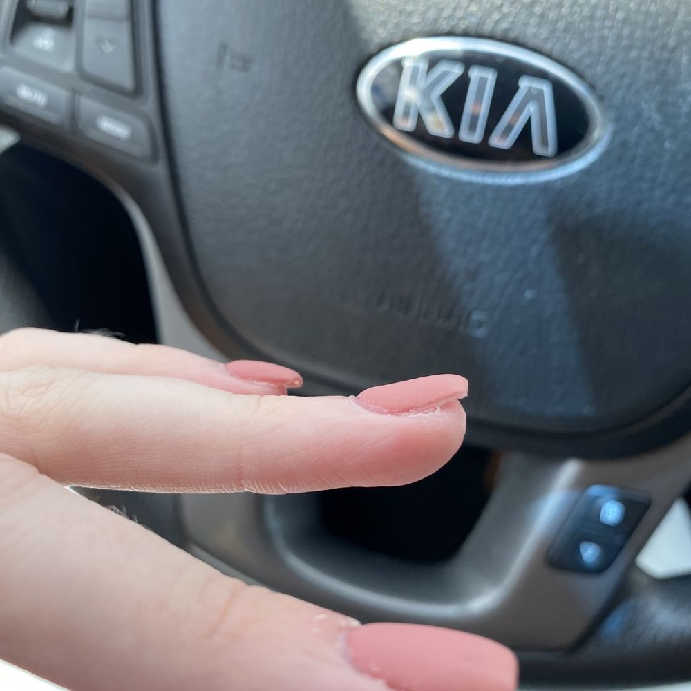 L-A Nails - Uneven ring fingernail - Nail Salons Near Me - Fond du Lac, Wisconsin L-A Nails - Uneven ring fingernail - Nail Salons Near Me - Fond du Lac, Wisconsin