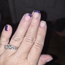 One week after gel manicure