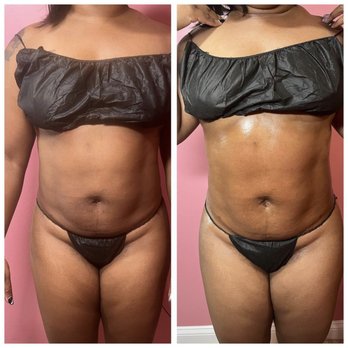 ビューティーバー 834fd9cf0615e18b9ef877b26a9da9