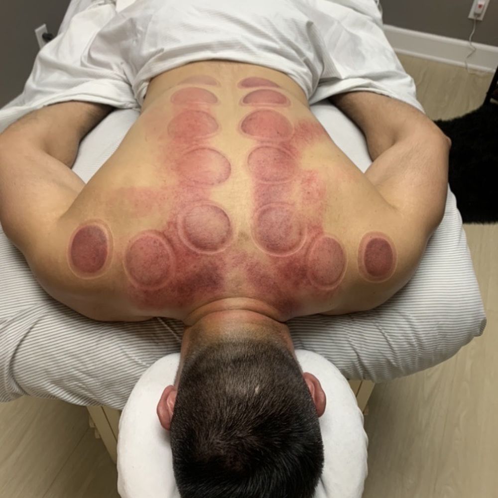 Knotted Up - Massage Therapy Near Me - Rancho Cucamonga, California Knotted Up - Massage Therapy Near Me - Rancho Cucamonga, California