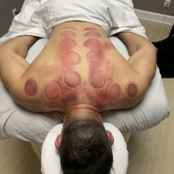 Knotted Up - Massage Therapy Near Me - Rancho Cucamonga, California Knotted Up - Massage Therapy Near Me - Rancho Cucamonga, California