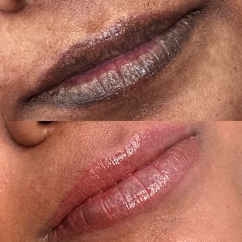 Minnow - Dark lip neutralization- 4 sessions - Permanent Makeup Near Me - Fremont, California Minnow - Dark lip neutralization- 4 sessions - Permanent Makeup Near Me - Fremont, California