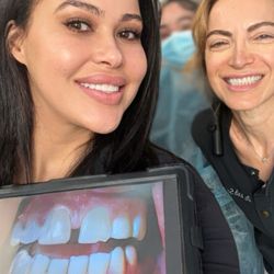 Smile SF - Dr Farah Sefidvash - Before and after