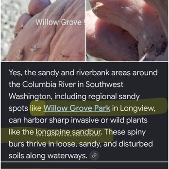 Willow Grove Park - My feet! - Parks Near Me - Longview, Washington Willow Grove Park - My feet! - Parks Near Me - Longview, Washington