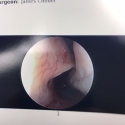 Chmiel James F MD