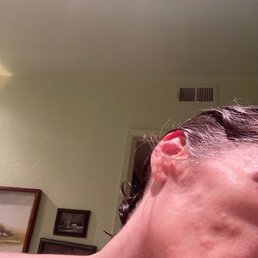 numerous bumps on my right cheek