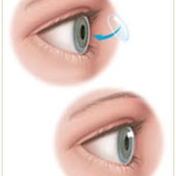 Alan D Gordon, MD - Center for Eye Care