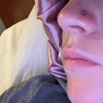 Black Dahlia Tattoo & Piercing - the nostril piercing about 5 hours after it was done - Tattoo Near Me - Riverton, Utah Black Dahlia Tattoo & Piercing - the nostril piercing about 5 hours after it was done - Tattoo Near Me - Riverton, Utah