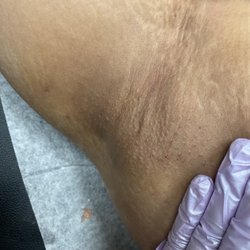 The Serial Waxer Co. - Armpit wax every 5 weeks with proper aftercare.