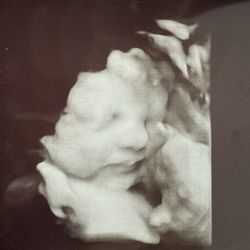 Sneak A Peek 3D Ultrasound - Baby smile