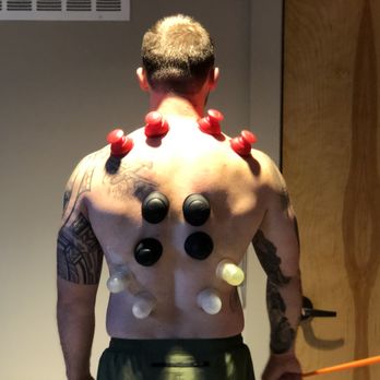 Whole Motion Therapy & Wellness - static cupping with dynamic resisted movement to provide neuromuscular re-education - Physical Therapy Near Me Whole Motion Therapy & Wellness - static cupping with dynamic resisted movement to provide neuromuscular re-education - Physical Therapy Near Me
