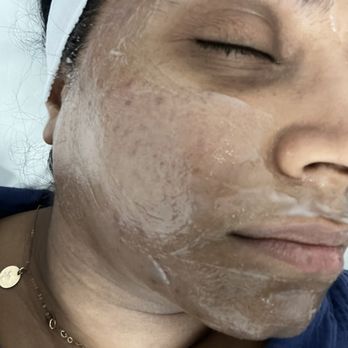 Ultimate Image MedSpa - Be sure to have them apply to areas like, under the eyes, around the nose, hairline, eyebrows, and jawline. - Laser Hair Removal Near Me - Plano, Texas