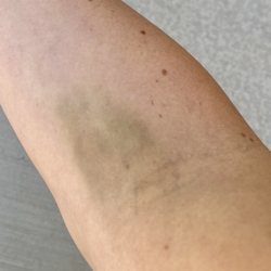 Quest Diagnostics - Result of Maria T! Totally unnecessary and uncalled for!