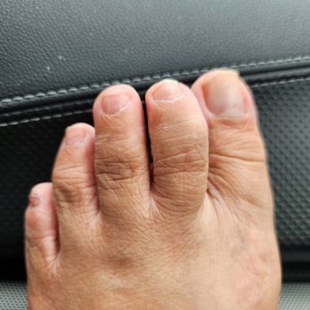Nailogy Lab - My nasty job of a "pedicure" (ignore the extremely dry toes). Uneven, jagged and unfiled toenails. - Nail Salons Near Me - Placentia, California Nailogy Lab - My nasty job of a "pedicure" (ignore the extremely dry toes). Uneven, jagged and unfiled toenails. - Nail Salons Near Me - Placentia, California