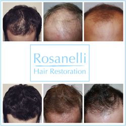 Tom Rosanelli, M.D.