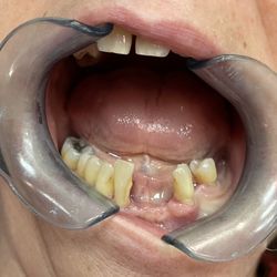 Mark Mancin, DDS - Before