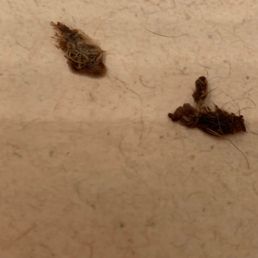 Pictures of the scabs after his dad pulled them off Pictures of the scabs after his dad pulled them off