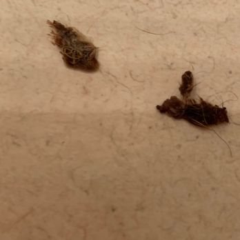 PetSuites Greenwood - Pictures of the scabs after his dad pulled them off - Pet Groomers Near Me - Greenwood, Indiana PetSuites Greenwood - Pictures of the scabs after his dad pulled them off - Pet Groomers Near Me - Greenwood, Indiana