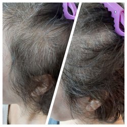 Grow on Scalp Care & Tattoo