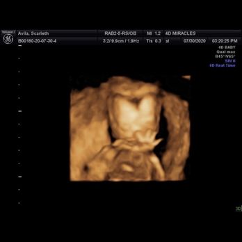 4D Miracles - Baby - Ultrasound Imaging Centers Near Me - Fremont, California 4D Miracles - Baby - Ultrasound Imaging Centers Near Me - Fremont, California