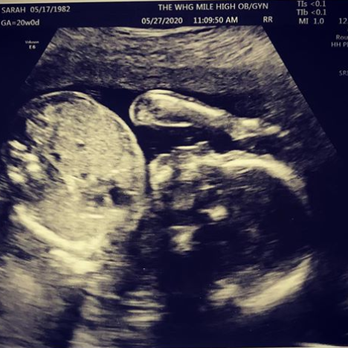 Gago Center For Fertility - Our little Gago baby - Fertility Near Me - Brighton, Michigan Gago Center For Fertility - Our little Gago baby - Fertility Near Me - Brighton, Michigan