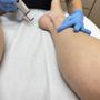 Photo of Ringpfeil Advanced Dermatology