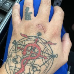 Concentra - Stitches removed! I'm free!:3