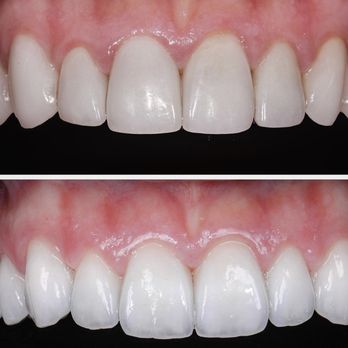 Sahar Verdi, DDS - veneers - Periodontists Near Me - Los Angeles, California Sahar Verdi, DDS - veneers - Periodontists Near Me - Los Angeles, California