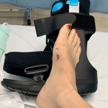 Robert Joseph, DPM - This was my Foot Before Dr Joseph Fixed it - Podiatrists Near Me - Beverly Hills, California Robert Joseph, DPM - This was my Foot Before Dr Joseph Fixed it - Podiatrists Near Me - Beverly Hills, California