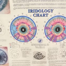 New Body Nutrition - Iris chart and a picture of my eyeball