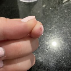 Touch Of Beauty - Nail glue stuck to my finger