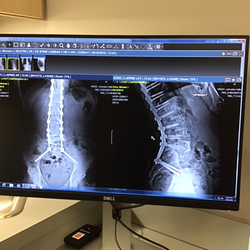 Joshua P Herzog - OrthoVirginia - Two