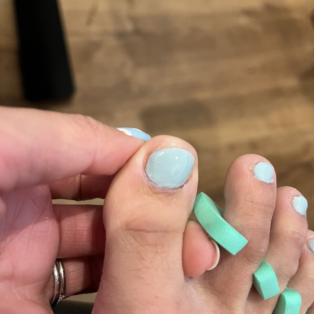 Pronails and Spa in Gainesville - Botched pedicure - Hair Removal Near Me - Gainesville, Florida Pronails and Spa in Gainesville - Botched pedicure - Hair Removal Near Me - Gainesville, Florida