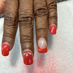 Nailize - Lifted and fungus under all the nails