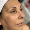 Total Body & Skin Rejuvenation gift card